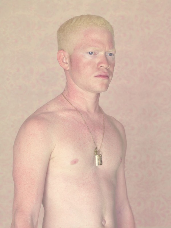 albinos-lacerda.-jpg