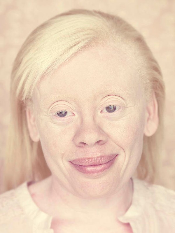 gustavo-lacerda-albinos-4