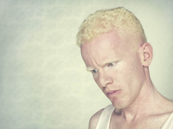 Gustavo-Lacerda-Albinos-5-580x435