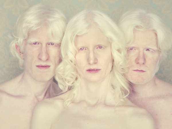 gustavo-lacerda-albinos